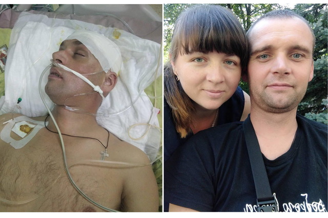 В Мечникова спасли мужчину с тяжелым  ранением мозга